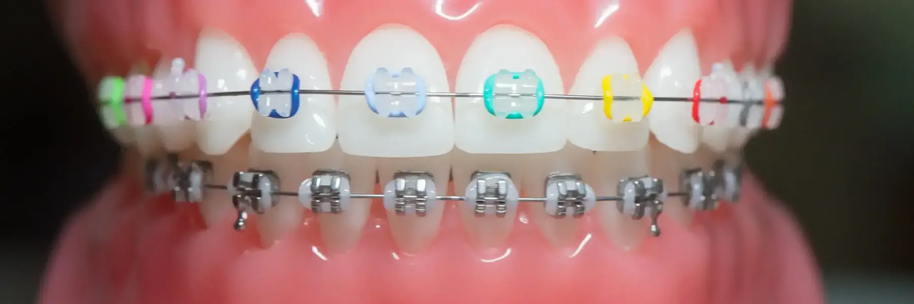 Orthodontics | Dentist
